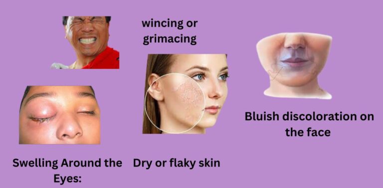 Heart disease symptoms in women on face